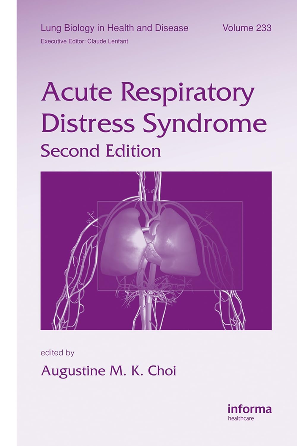 Acute Respiratory Distress Syndrome (Lung Biology in Health and Disease)      2nd Edition, Kindle Edition