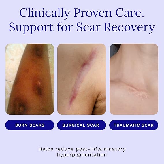 Rejuvaskin Scar Esthetique Scar Cream with Silicone, Reduces the Appearance of Surgical Scars, Burns, Stretch Marks, Keloids & Acne Scars, 10ml/0.338 Oz