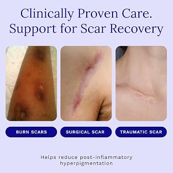 Rejuvaskin Scar Esthetique Scar Cream with Silicone, Reduces the Appearance of Surgical Scars, Burns, Stretch Marks, Keloids & Acne Scars, 10ml/0.338 Oz