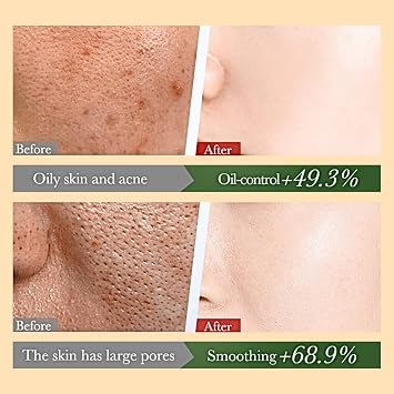 Centella Korean Toner Pads, Centella Face Exfoliator Pads for Dark Spots Remover, Wrinkles & Dull Skin, Soothing & Exfoliating Face Padswith Snail Mucin, Niacinamide, Peptides, 100 Count