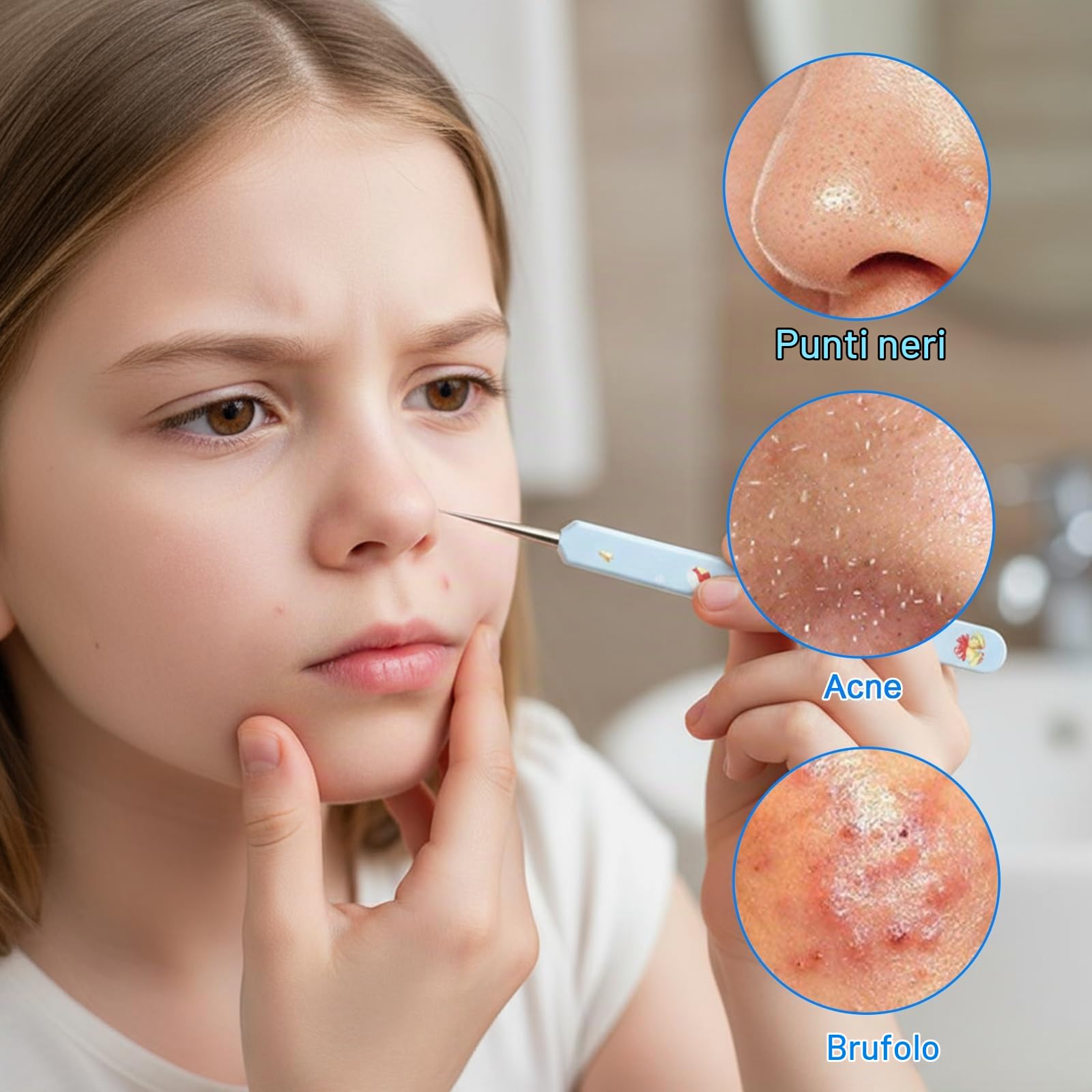 Estrattore di Punti Neri, Metallo 2 in 1 Ago per la Pulizia Dell'Acne, Schiaccia Punti Neri Strumenti, Rimozione di Punti Neri per Naso e Viso