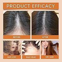 Vista 5 de Ampollas para el Crecimiento del Cabello, aceite de regeneración del cabello, repara y promueve el crecimiento del cabello, ampolla de fuerza