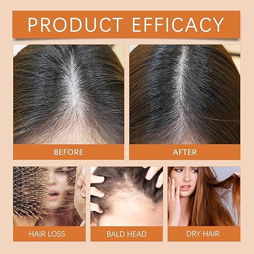 Miniatura 5 de Ampollas para el Crecimiento del Cabello, aceite de regeneración del cabello, repara y promueve el crecimiento del cabello, ampolla de fuerza del