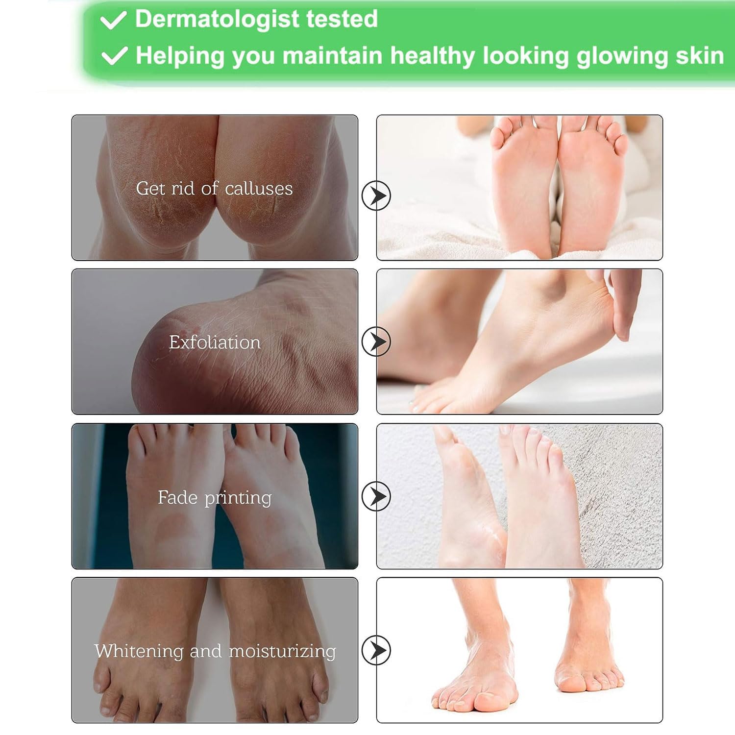 Lot de 3 paires de masques pour les pieds - Soin des callosités et des peaux mortes - Masque anti-âge - Exfoliant - Pour les pieds - Spa exfoliant - Pour femmes et hommes - Style rose classique