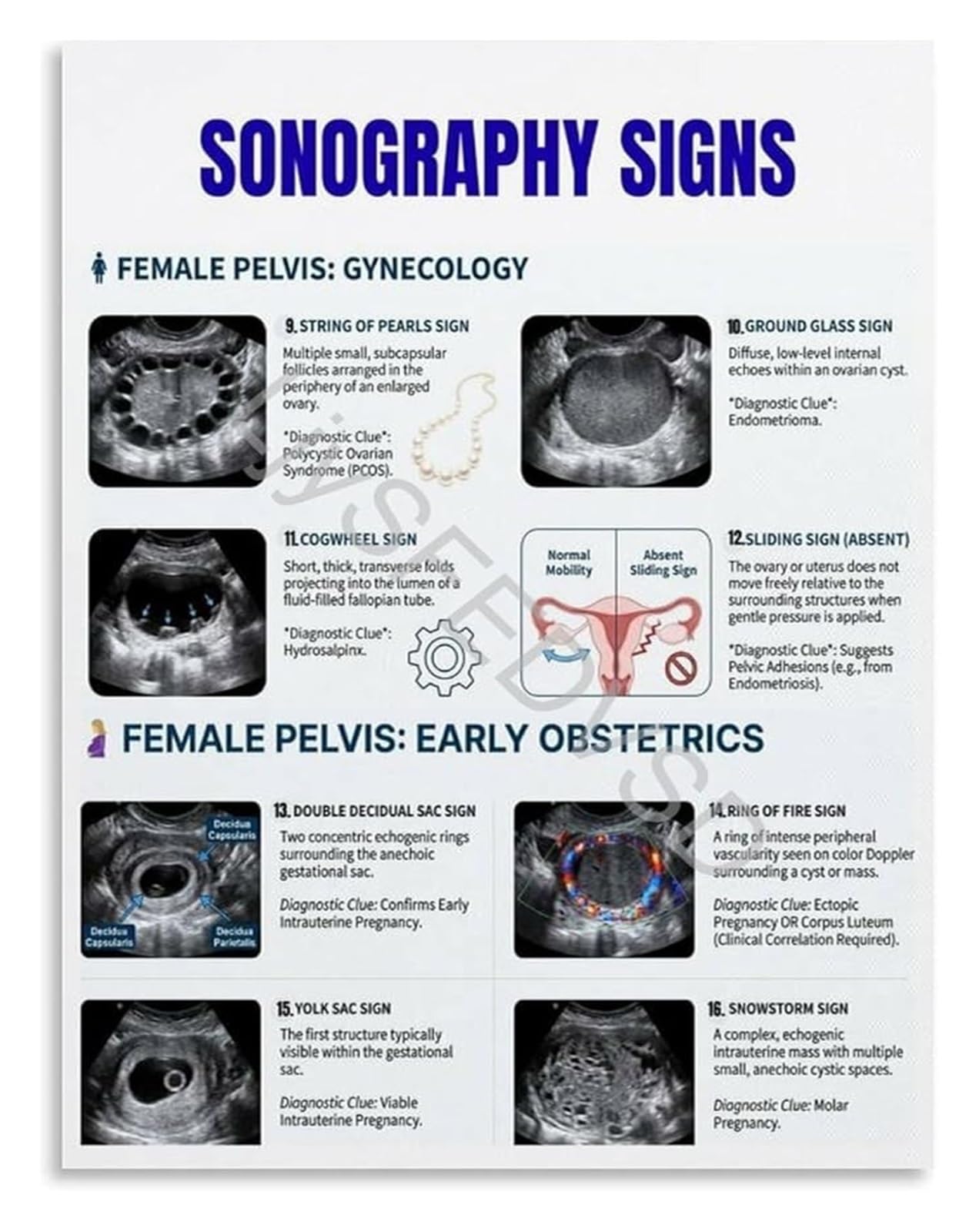 AUOQKQUT Female Pelvic Ultrasound Signs Poster Gynecology Early Obstetrics Sonography Guide Canvas for Education Framed,08x12inch(20x30cm)