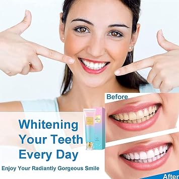 2PC Niacinamide Toothpaste, Niacinamide Whitening Toothpaste, Intensive Nicotinamide White Teeth, Fresh Breath, Stain Removal