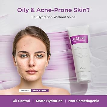 AcMist Face Moisturizing Cream Gel for Acne Prone & Oily Skin Enriched with Vitamin E, Aloe Vera & Squalane Oil-free, Non Comedogenic & Quick Absorbing Formulation For All Skin Types, 50gm