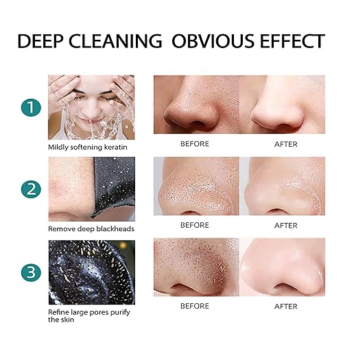 Miniatura 4 de 20 parches nasales de limpieza profunda, parches de nariz para mejorar puntos negros, espinillas, acné, zit, tiras nasales de limpieza profunda para