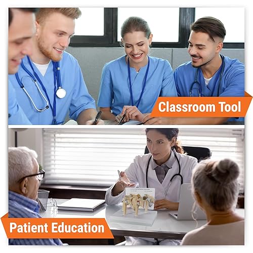 Miniatura 10 de Modelo de columna vertebral  Réplica de anatomía corporal humana de condiciones de vértebras de cuatro etapas para médicos herramienta educativa de