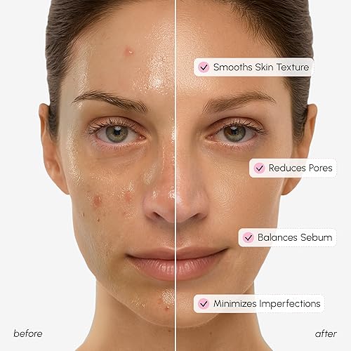 Miniatura 4 de MAREE Minimizador de Poros para Tónico Facial  Tónico de Hamamelis con Niacinamida y Colágeno Marino  Tónico Facial Exfoliante Suave para Control de