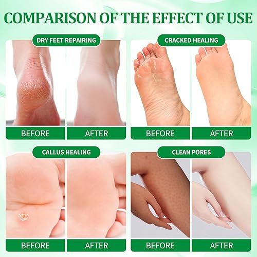 Miniatura 3 de Kit de Pedicura con Set para Remojar Pies Sal Efervescente, Exfoliante de Azúcar, Mascarilla de Masaje, Loción de Masaje en una Caja, Kit de Spa de