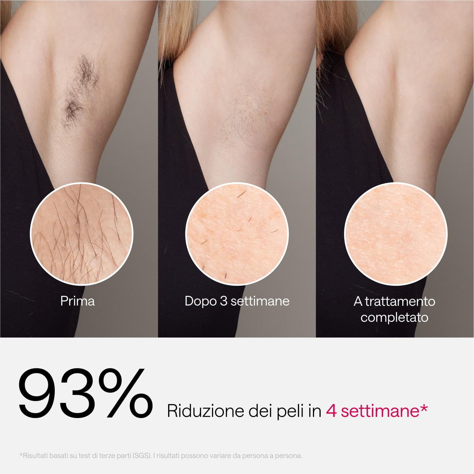 Ulike Air 3 Épilateur IPL pour les Femmes & Hommes – Épilation Laser avec Sapphire Ice Cooling, Résultats Durables et Presque Indolores, Tête Plate pour Corps et Visage, Violet
