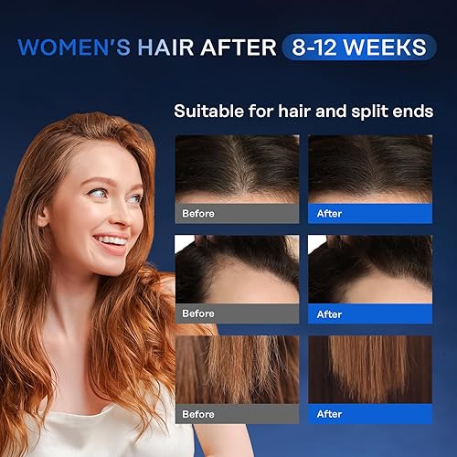 Miniatura 4 de Suero para el crecimiento del cabello, 5% de minidil y biotina para hombres y mujeres, detén la pérdida y el adelgazamiento del cabello, aerosol