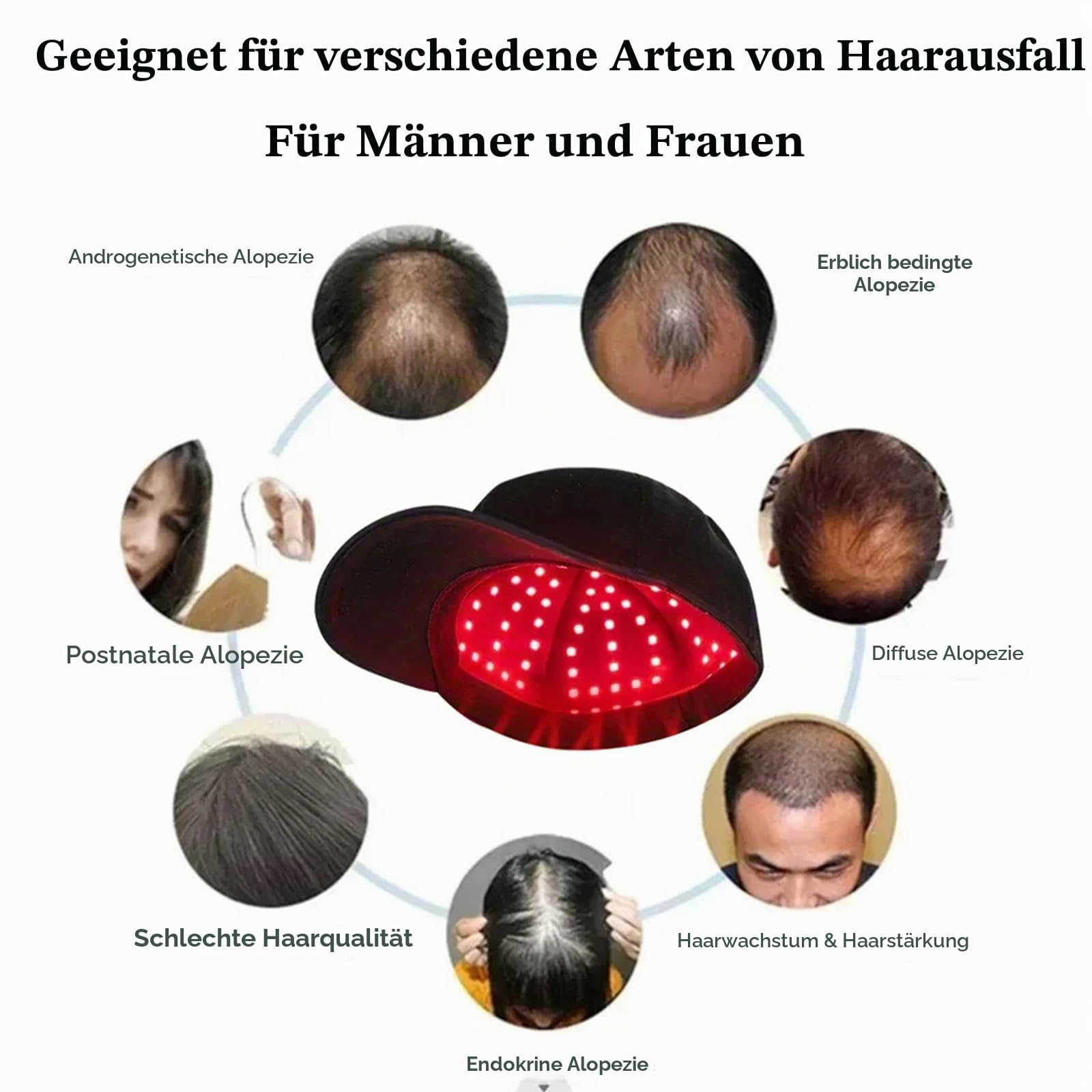 GOURIXIN Laser Cap Rotes Licht Therapie Cap für Haarwachstum, Rotlichtlampe Haare Anti-Haarausfall, 300 LED-Lampenperlen Therapiekappe 660nm 850nm, mit USB Aufladung und Abnehmbarem Panel