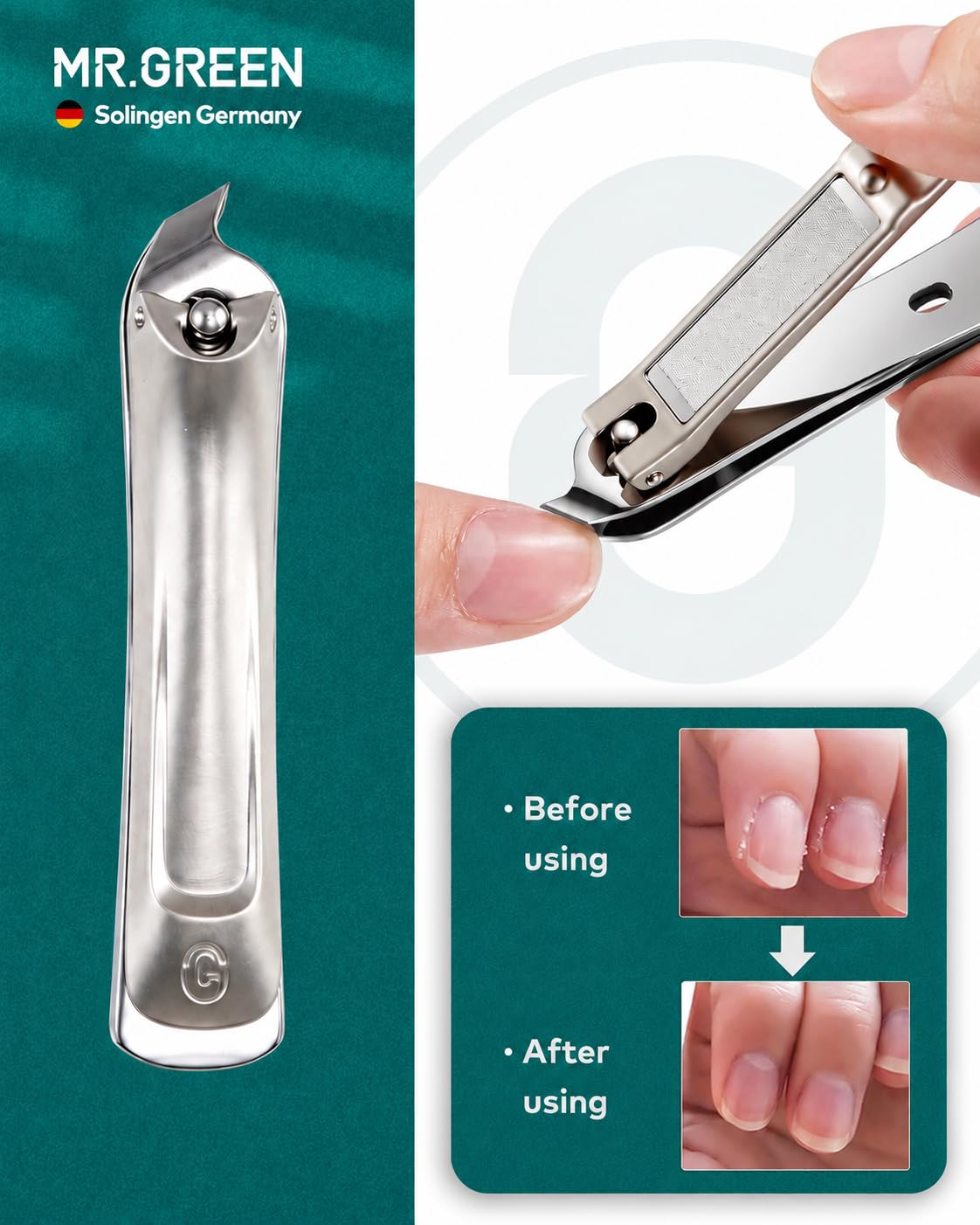 MR.GREEN Cortaúñas 6 en 1 para hombres y mujeres, kit de manicura y pedicura de acero inoxidable, juego profesional de cortaúñas de manos y pies, kit de aseo de uñas simplificado y práctico con funda