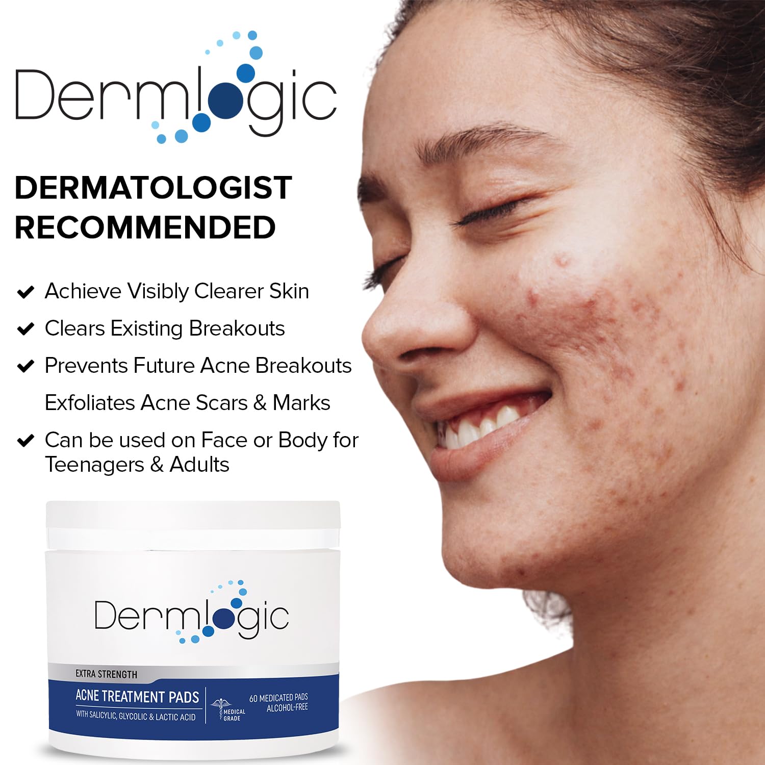 Acne Treatment Pads- Contains Salicylic, Glycolic, & Lactic Acid for Face & Body. Clears Away Clogged Pores, Oily Skin & Cystic Breakouts. Removes Dark Spots, Blackhead & Whitehead Pimples