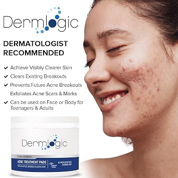 Acne Treatment Pads- Contains Salicylic, Glycolic, Lactic Acid for Face & Body. Clears Away Clogged Pores, Oily Skin & Cystic Breakouts. Removes Dark Spots, Blackhead & Whitehead Pimples