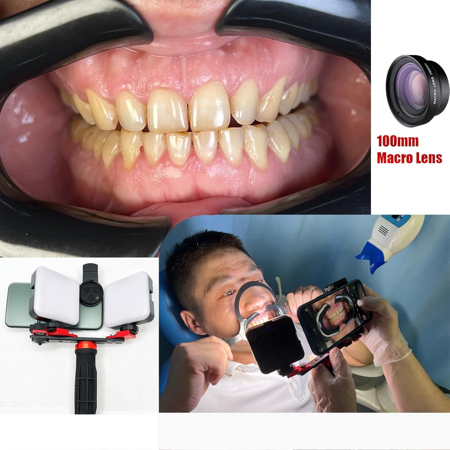 Équipement De Macrophotographie Intra-orale Lumière De Remplissage Buccal Complète Kit De Photographie De Lampe De Poche Dentaire pour La Prise De Photos Et De Vidéos
