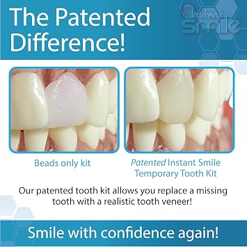 Instant Smile Complete Your Smile Temporary Tooth Replacement Kit with Extra Fitting Material