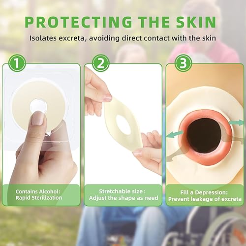 Miniatura 6 de 10 anillos de barrera para ostomía, suministros de ostomía de 0.157 in sin fugas, anillos extensores de piel hidrocoloides para bolsas de