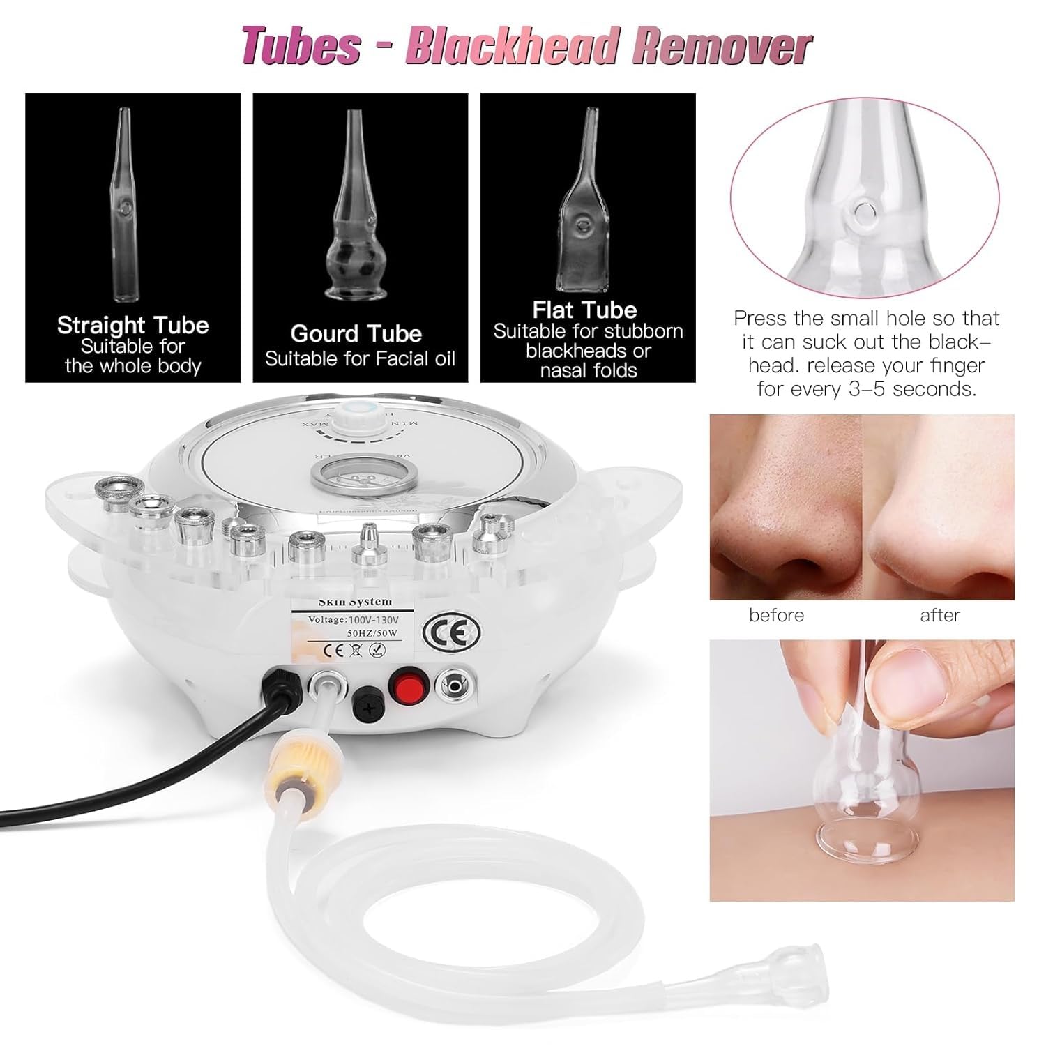 TopDirect - Macchina diamantata 3 in 1, attrezzatura per la cura della pelle del viso, dispositivo di bellezza con pistola a spruzzo (forte potenza di aspirazione: 65-68 cmhg)