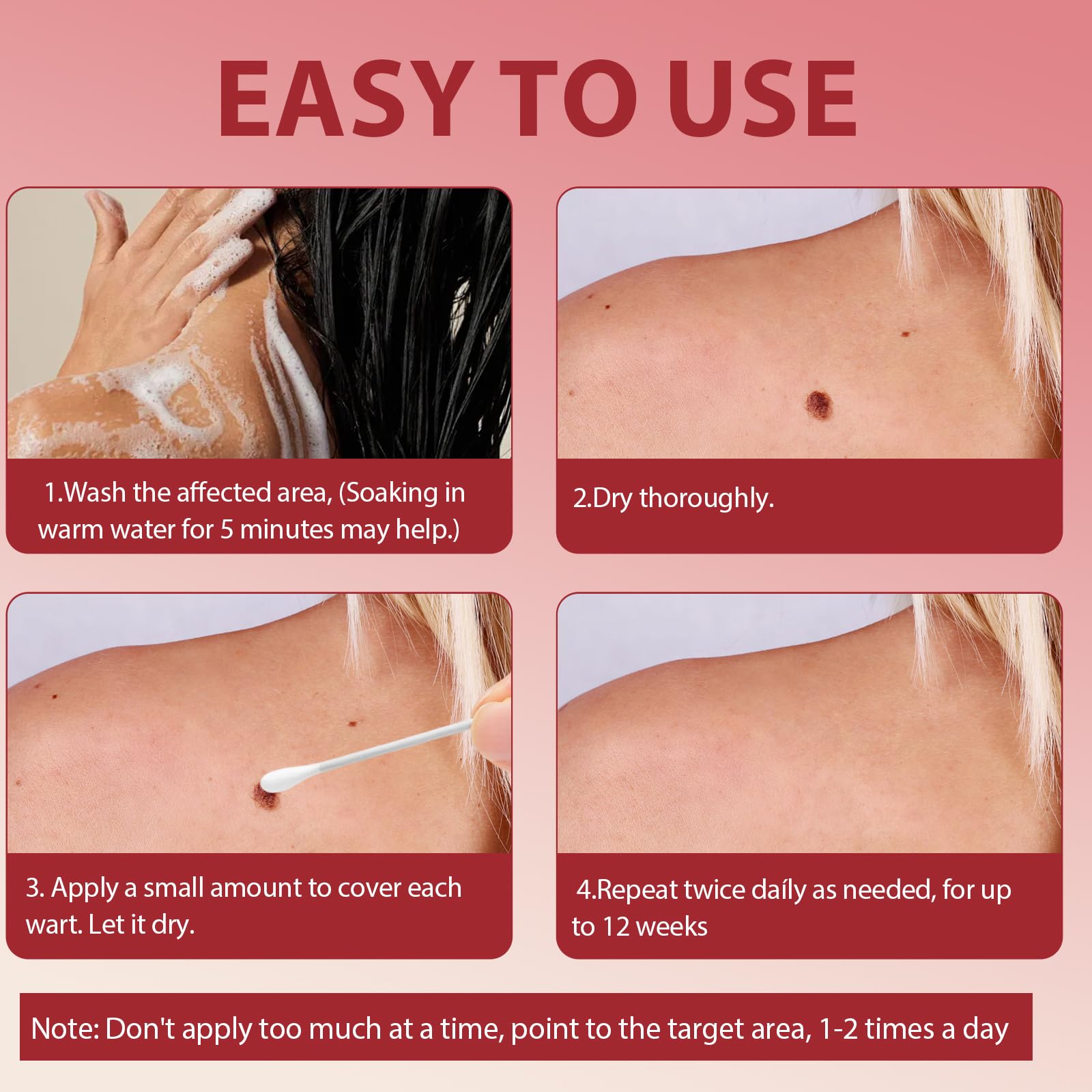 20g Eliminador De La Piel Verrugas Crema, Eliminación las Verrugas en los pies, Manos y Cuerpo, Atención Diaria, Adecuado para Partes del cuerpo