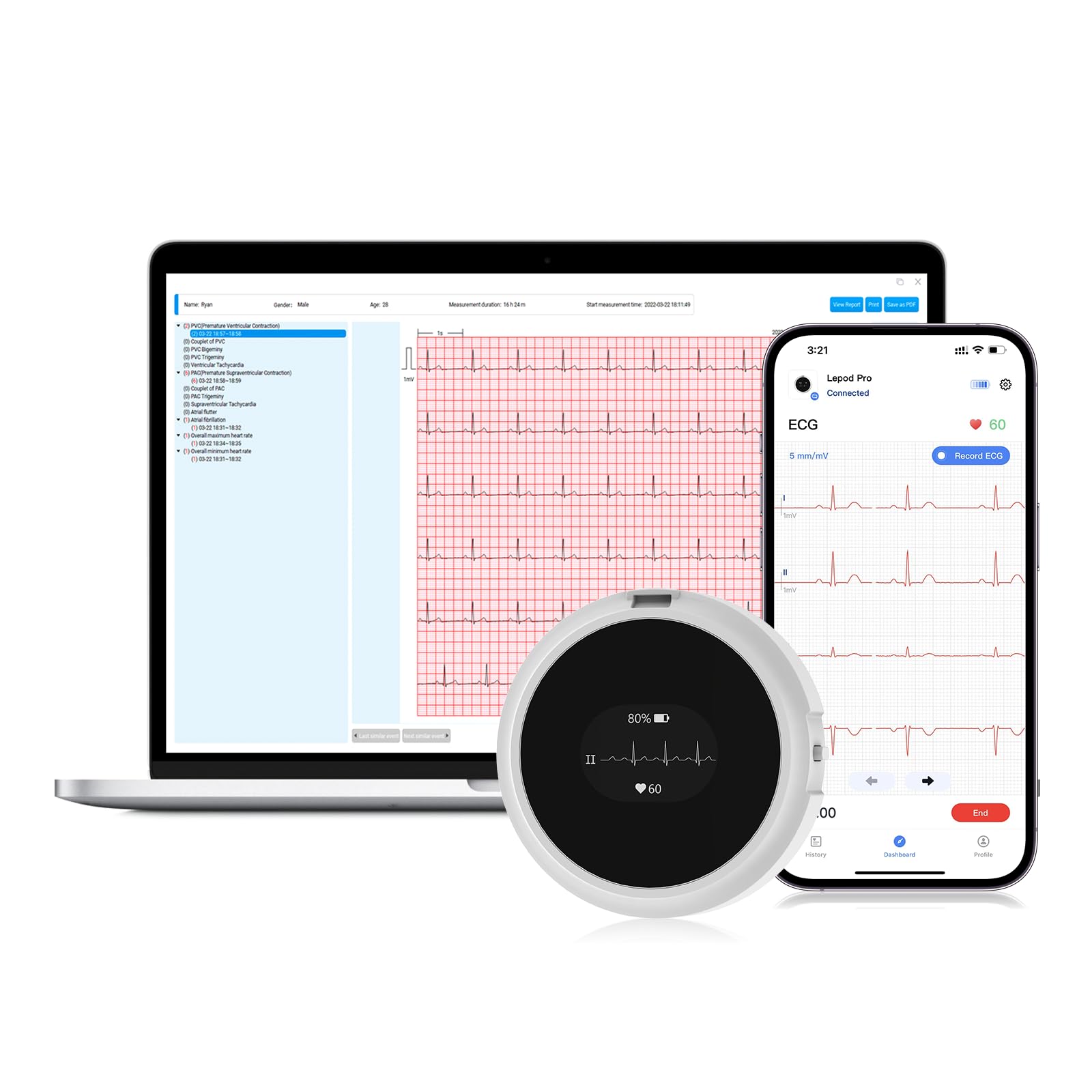 Wellue LP12 ECG portatile a 12 derivazioni con display OLED, registrazione ECG in tempo reale 24 ore su 24, rapporti ECG AI dettagliati, marcatori di eventi, ricaricabile, Supporta app mobile e PC