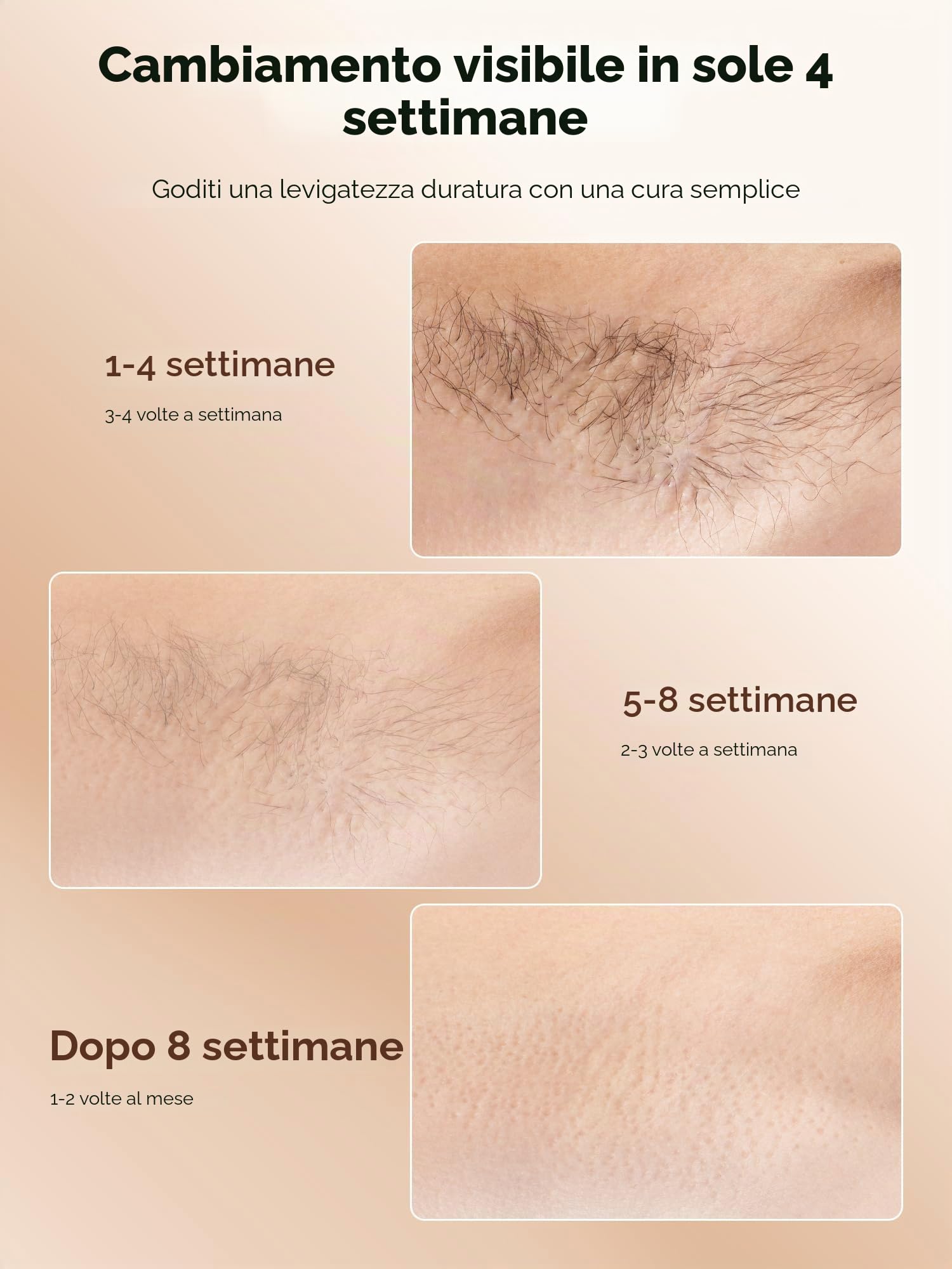 Epilatore Luce Pulsata IPL Indolore IP, Epilatore Laser con Raffreddamento,9 Livelli Regolabili Dispositivo Depilazione per Donna e Uomo, Viso Corpo Ascelle, Bianco Dorato