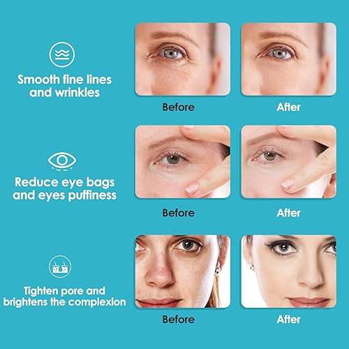 Miniatura 5 de Juego de globos de hielo azules, 2 piezas grandes y 2 mini globos de hielo para faciales incluidos, globos de hielo frío para aliviar la hinchazón