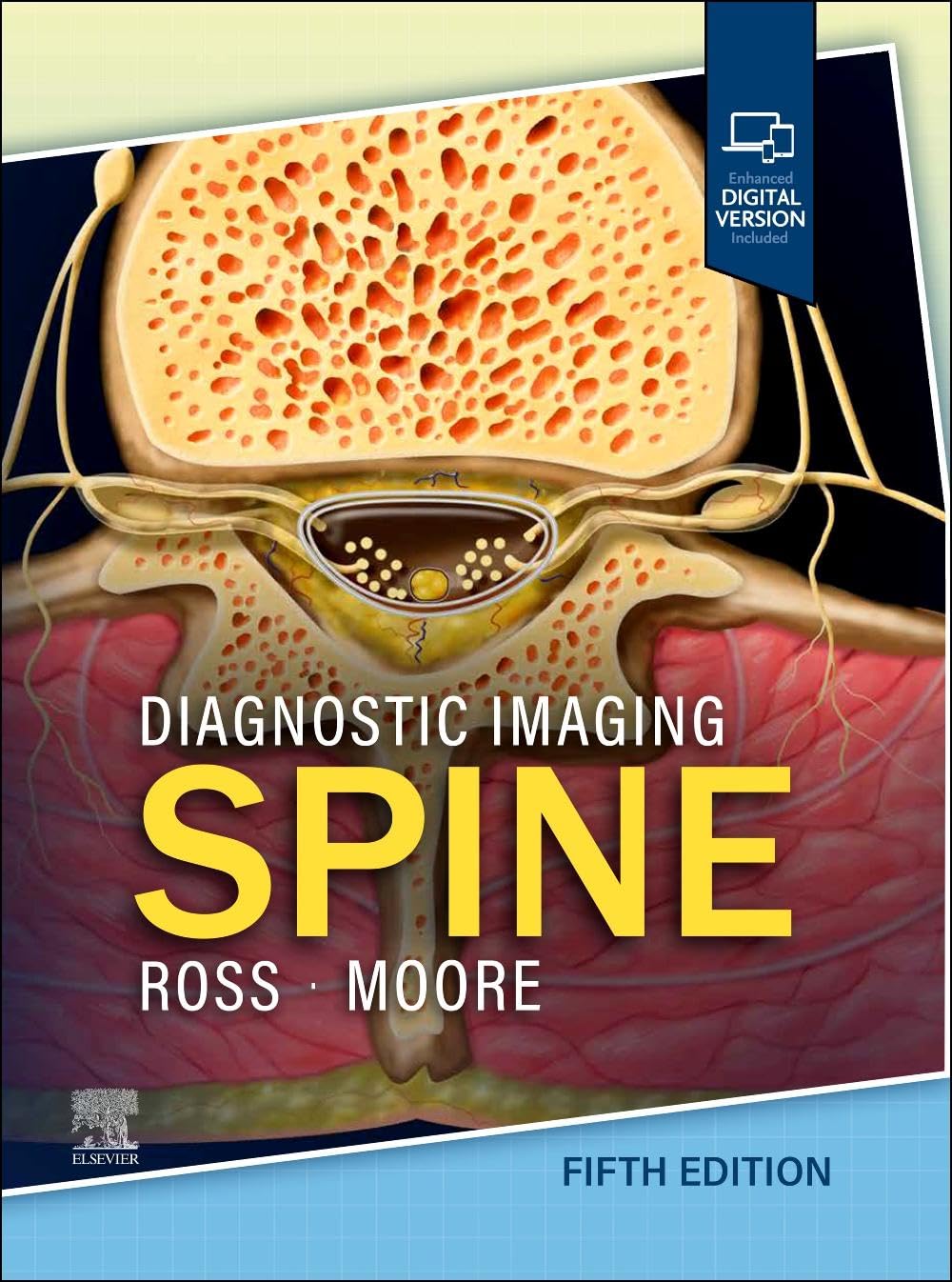 Elsevier Diagnostic Imaging - Spine