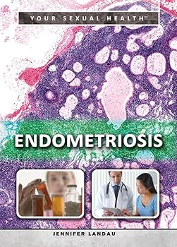 Library Binding Endometriosis Book