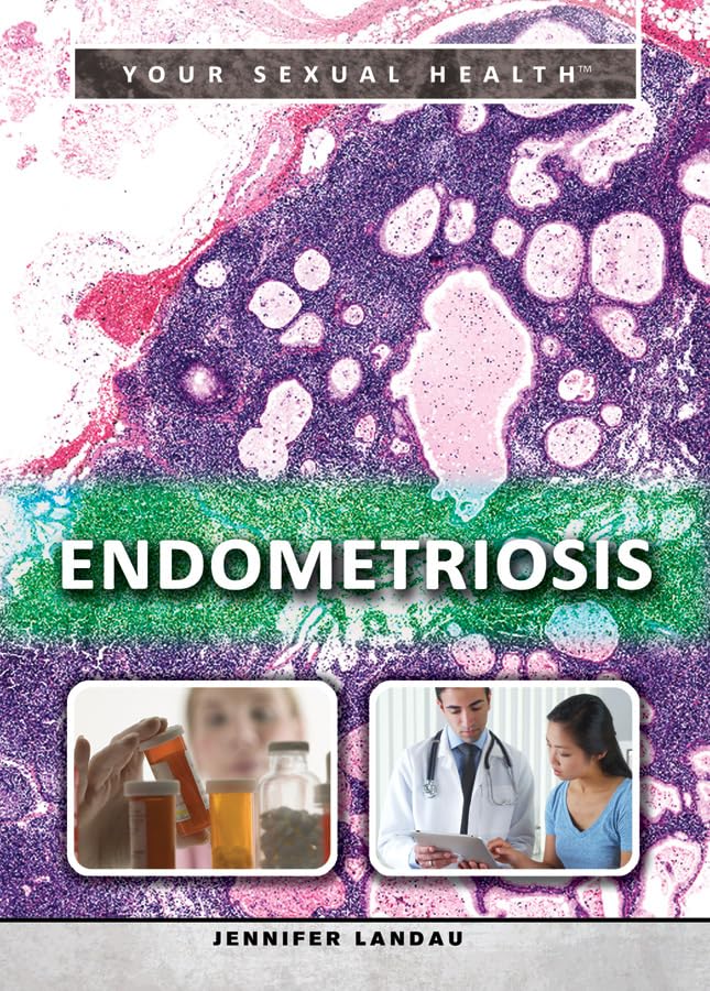Endometriosis (Your Sexual Health, 2)      Library Binding – July 30, 2015