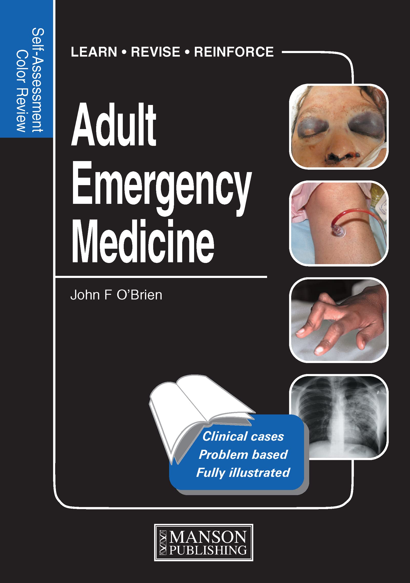 Adult Emergency Medicine: Self-Assessment Color Review (Medical Self-Assessment Color Review Series)