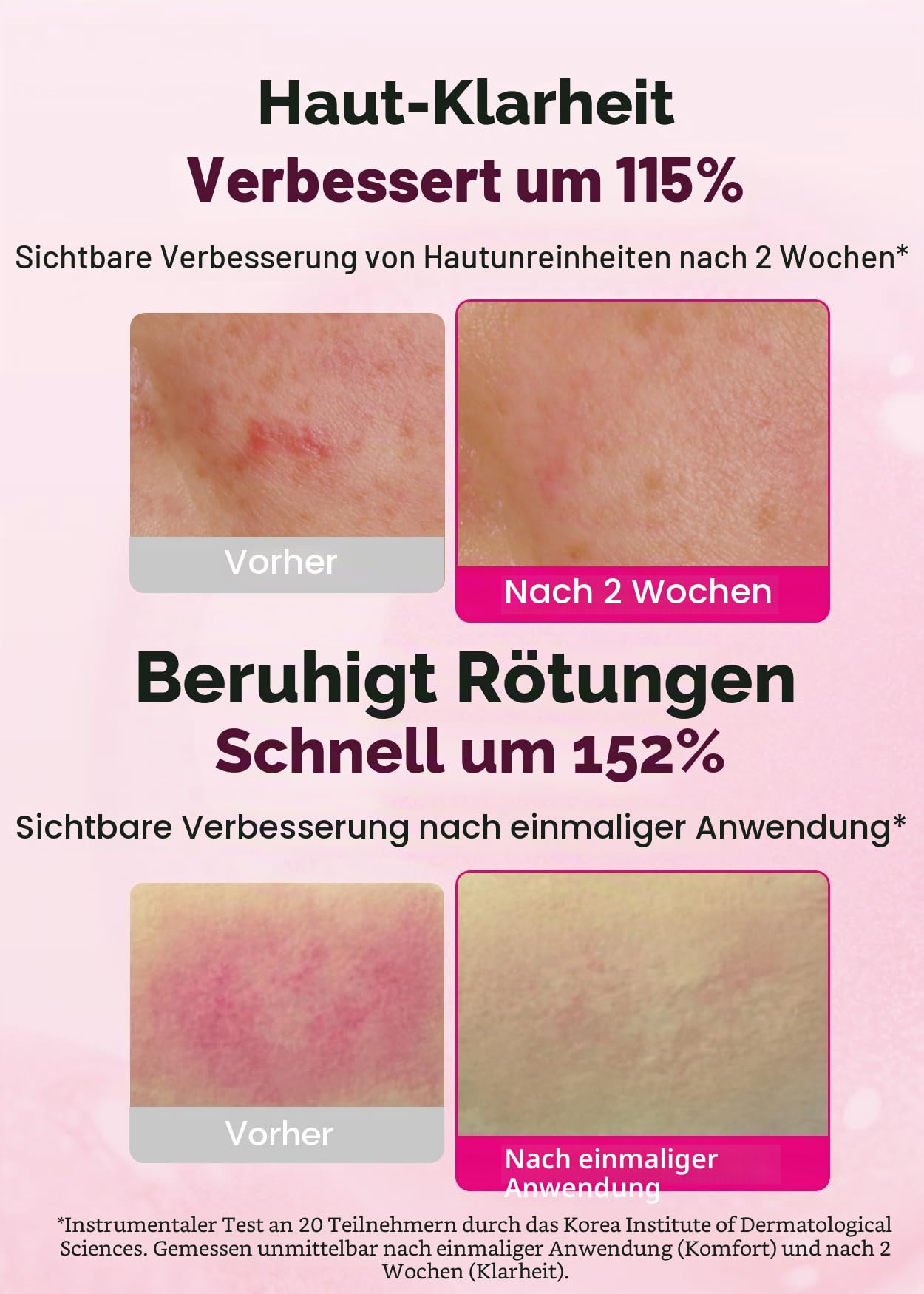 ISOI Brightening Serum – Aufhellendes Gesichtsserum mit Vitamin C & PDRN, gegen Pigmentflecken mit Bulgarischer Rose, Niacinamide & Hyaluron, Koreanisch | K-Beauty 35 ml | Hydrating Formula, Skin Barrier Support, Moisture Balance, Glass Skin Look