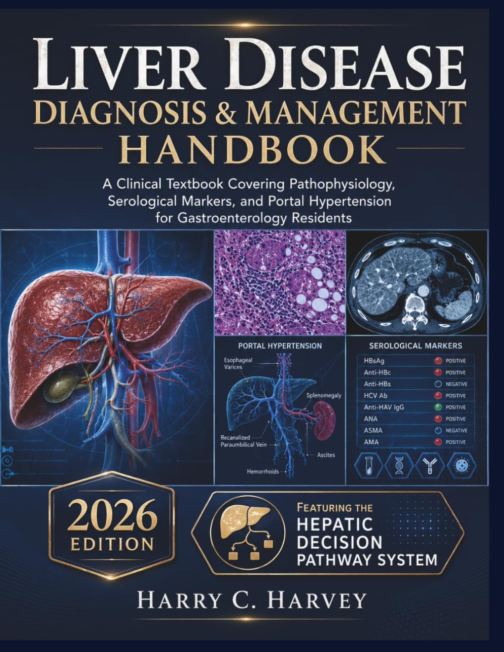 Liver Disease Diagnosis & Management Handbook: A Clinical Textbook Covering Pathophysiology, Serological Markers, and Portal Hypertension for Gastroenterology Residents