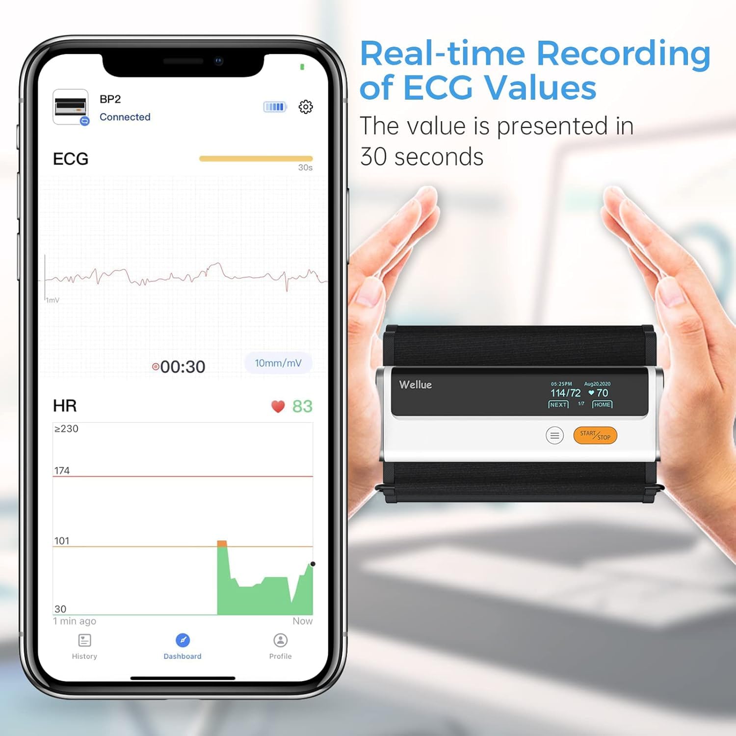 Wellue Armfit Plus Tensiómetro de Brazo Digital con Función de ECG, Monitor para la Presión Arterial, APP de Conexión Bluetooth para iOS y Android