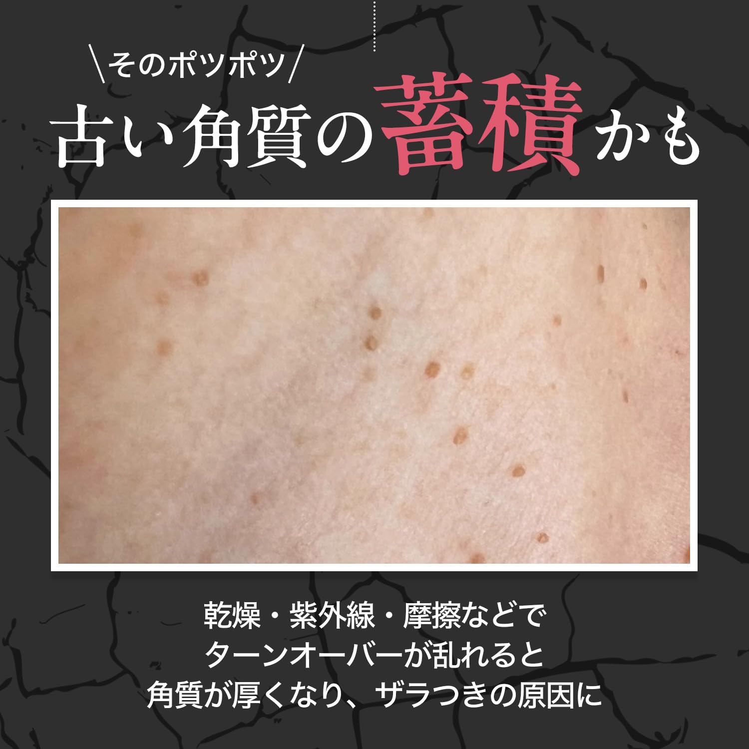 ばいばイボ 首 デコルテ 薬用SKIN SMOOTHER Amazon.co.jp: ばいばイボ 首 デコルテ 薬用SKIN SMOOTHER 医薬部外品