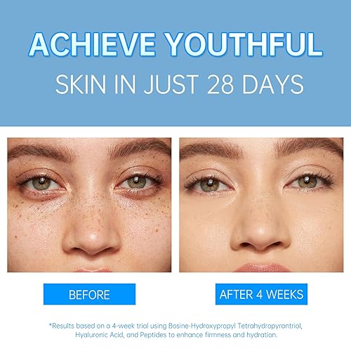 Miniatura 5 de VGO Pro-Xylane Active Cream  Reafirmante y reafirmante, hidratante de reparación facial diaria para todo tipo de piel, 1.02 oz (30 g)