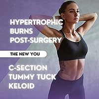 Vista 2 de Hojas de silicona prémium para cicatrices Grado médico, acción rápida para cesáreas, queloides, quemaduras, cicatrices de abdominoplastia