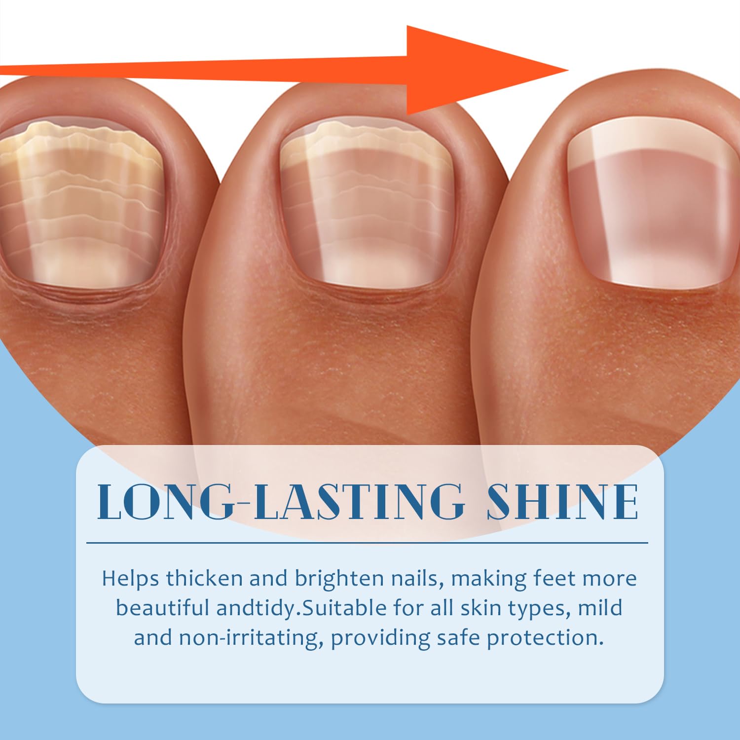 Optimised Nail Protection Patches for Overnight Foot and Toenail Care - Image 3