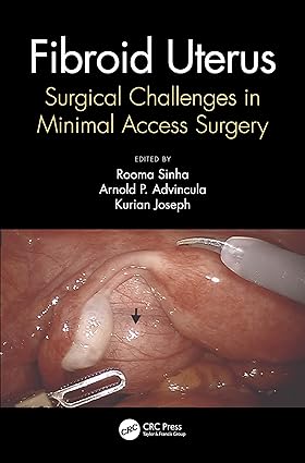 FIBROID UTERUS SURGICAL CHALLENGES IN MINIMAL ACCESS SURGERY (HB 2021)