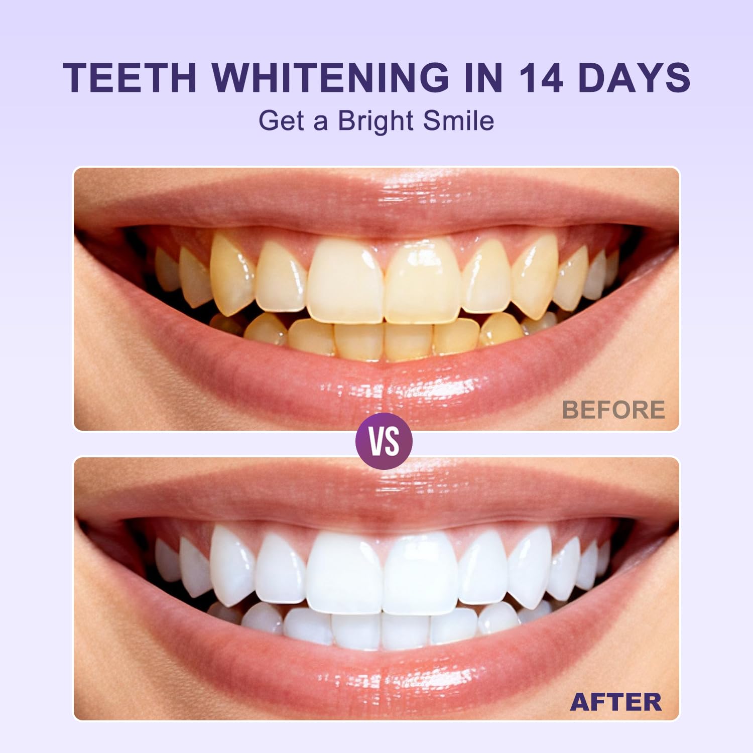 Purple Teeth Whitening Strips - Professional-Grade Whitening, Effectively Removes Stains and Bad Breath Caused by Smoking, Drinking, and Coffee,Achieve a Beautiful and Confident Smile(14 PCS, Mint) — view 5