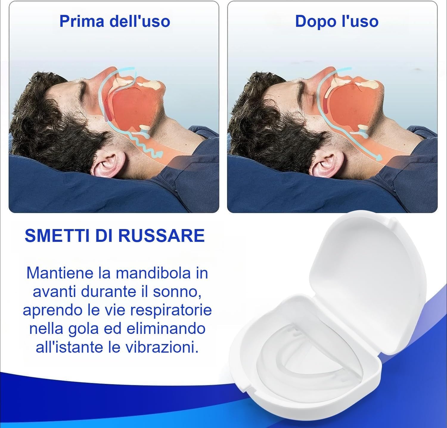 Rinovax Bite Antirussamento-Dispositivo Antirussamento Rinovax - Supporto per un Sonno Sereno,Aiuta a Ridurre il Russare,Migliorare la respirazione e il comfort,Facile Da Pulire (1PCS)