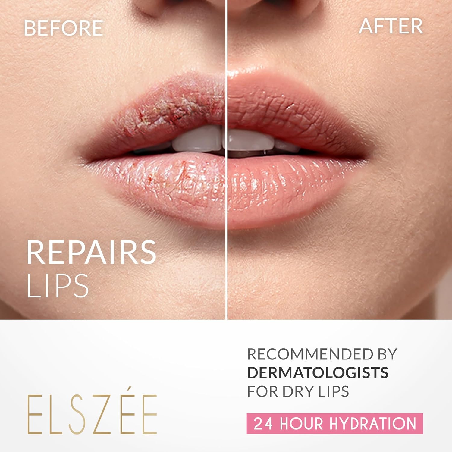 ELSZÉE Loveable Lips | Lip Mask with Hyaluronic Acid | Smooth, Volumize and Hydrate Dry Lips | Day & Night Treatment - Image 5
