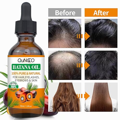Miniatura 4 de QUNGCO Batana - Aceite hidratante para el cabello, acondicionador profundo para cabello seco