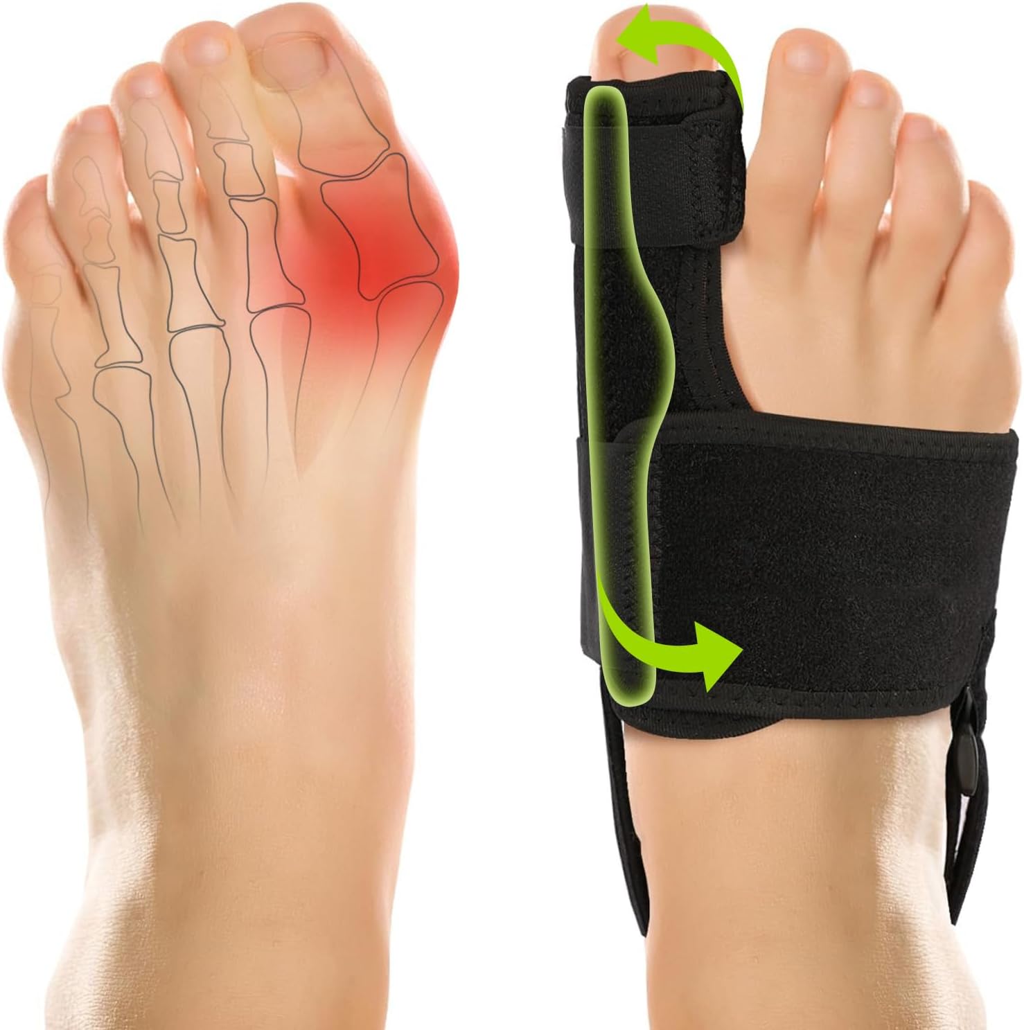Vicorrect Adjustable Bunion Corrector for Women and Men: Orthopedic Bunion Splint Pain Relief for Day/Night Support (2PC) (Black-1)
