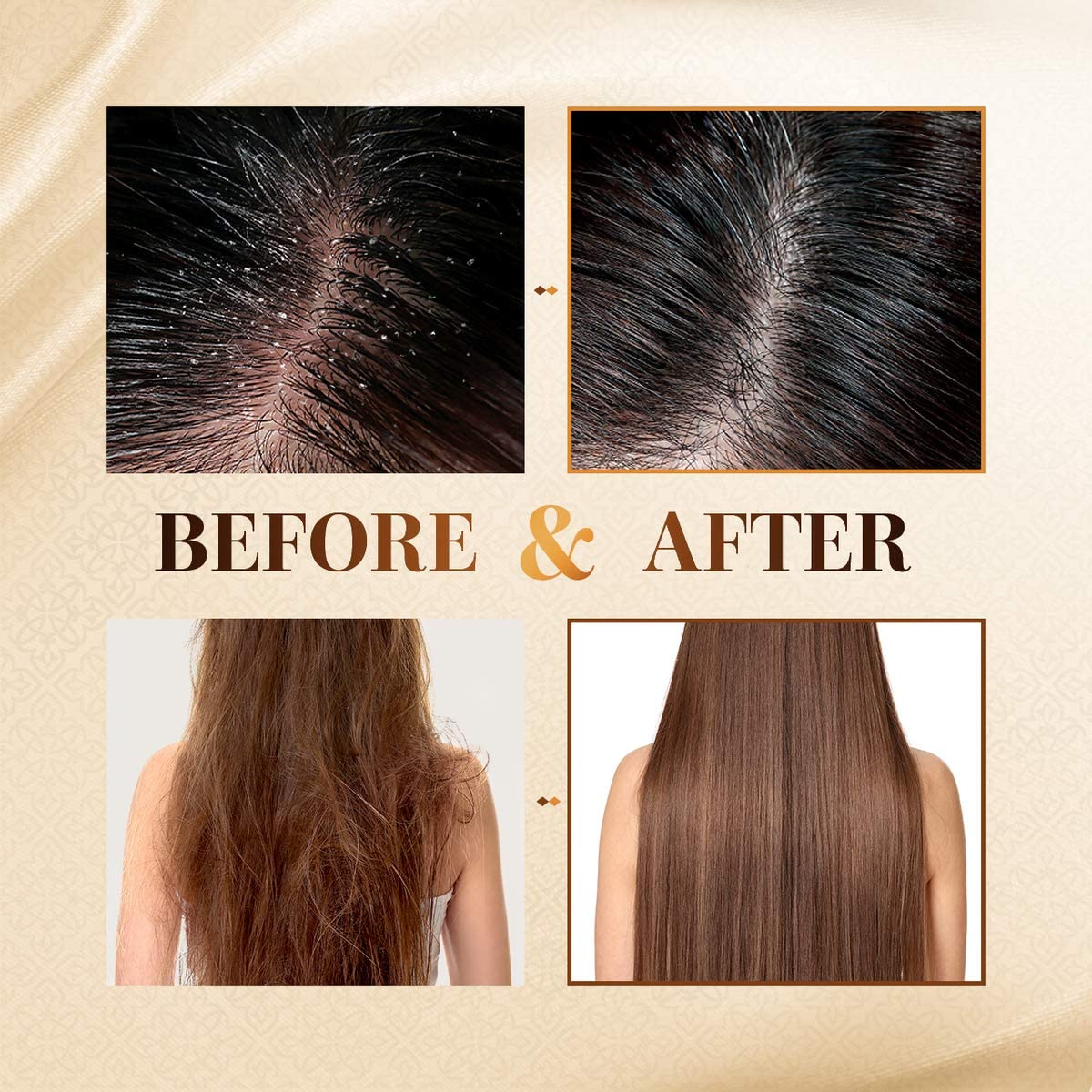 CP-1 Ginger Purifying Conditioner, Repair damaged hair, Scalp care, Recovery Strengthen care, 500 ml, 500 ml (Pack of 1) - Image 4