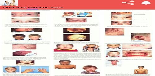 Illustrated Pediatric Signs