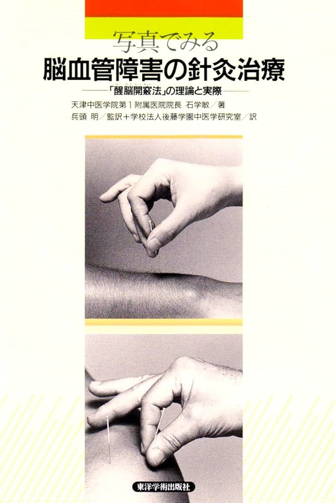 写真でみる脳血管障害の針灸治療: 「醒脳開竅法」の理論と実際
