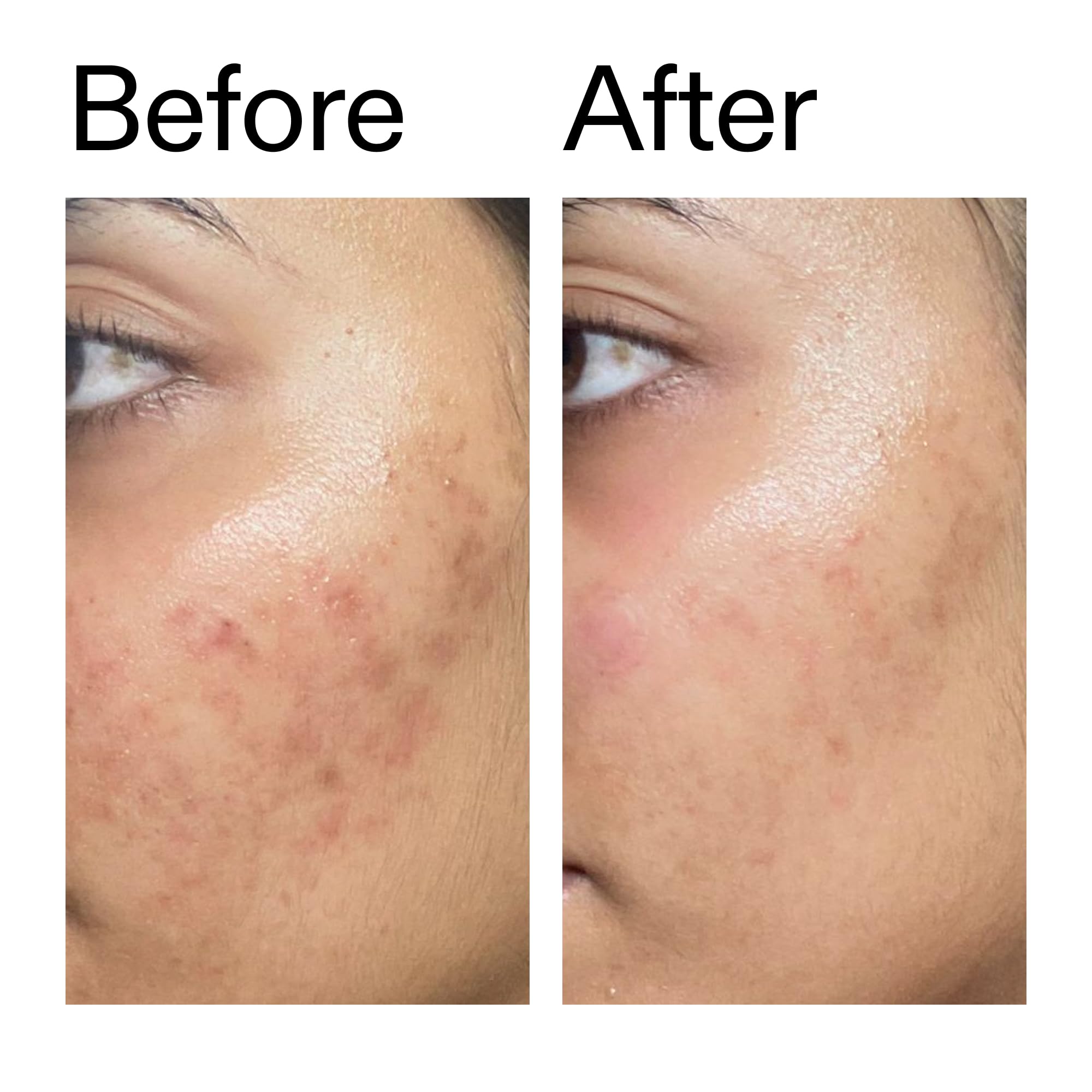 Ectoin Hydro-Barrier Serum - The INKEY List -8
